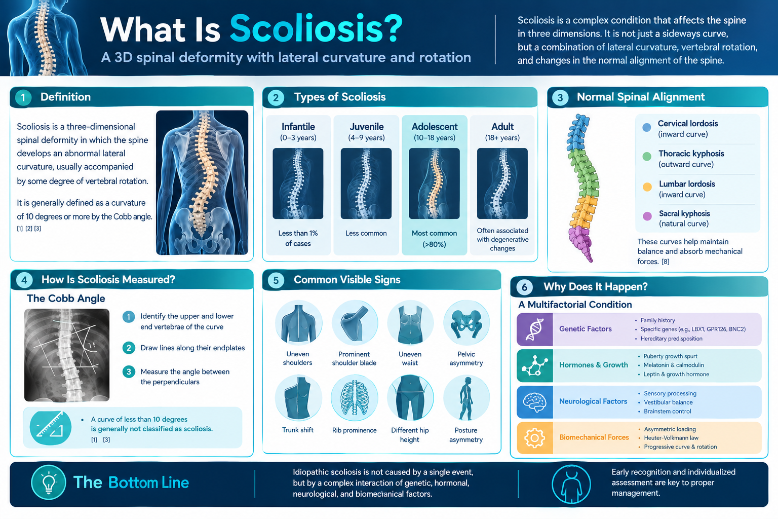 What Is Scoliosis? Definition, Types, Causes, and Spinal Alignment Explained